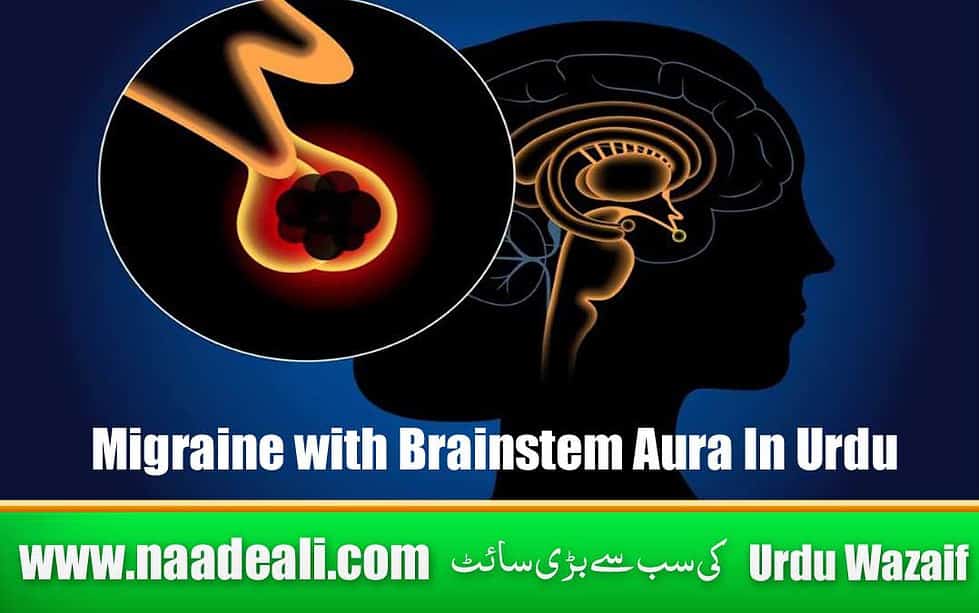 migraine-with-brainstem-aura-in-urdu-naade-ali-urdu-wazaif